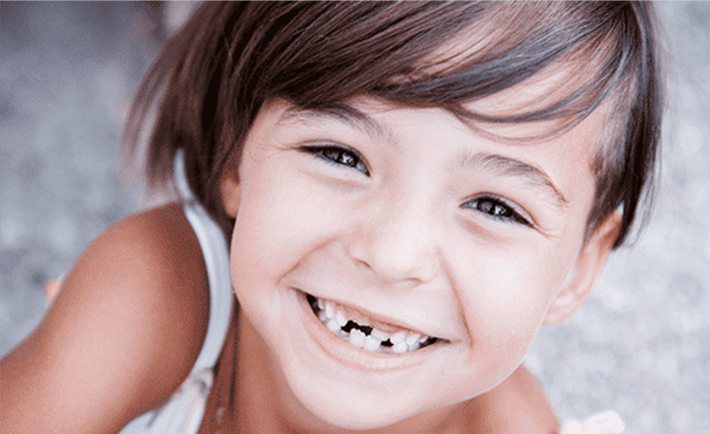 5 Summer Dental Tips for Kids_Palo Alto Dentists