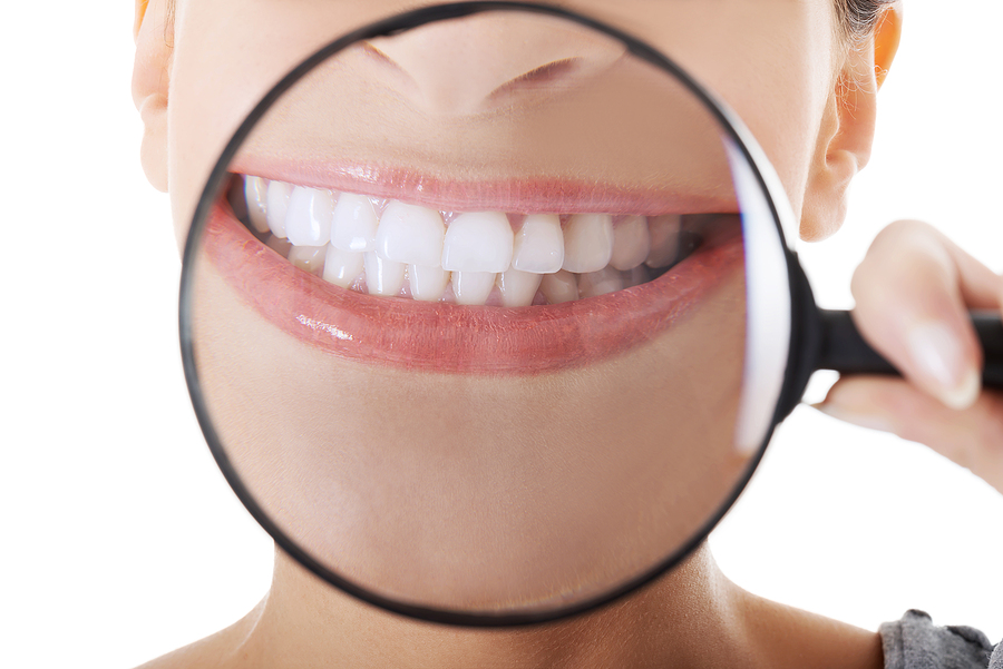 Rebuilding Smiles in Palo Alto, CA: How Dental Implants Promote Jawbone Health and Enhance Facial Structure