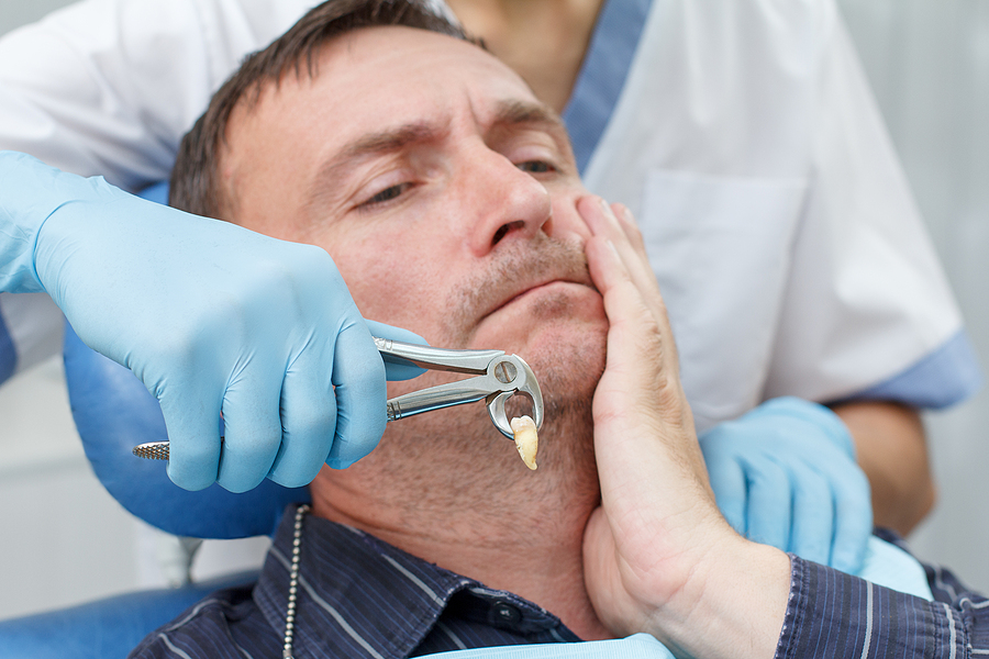 A Complete Guide to Teeth Extractions in Palo Alto, CA